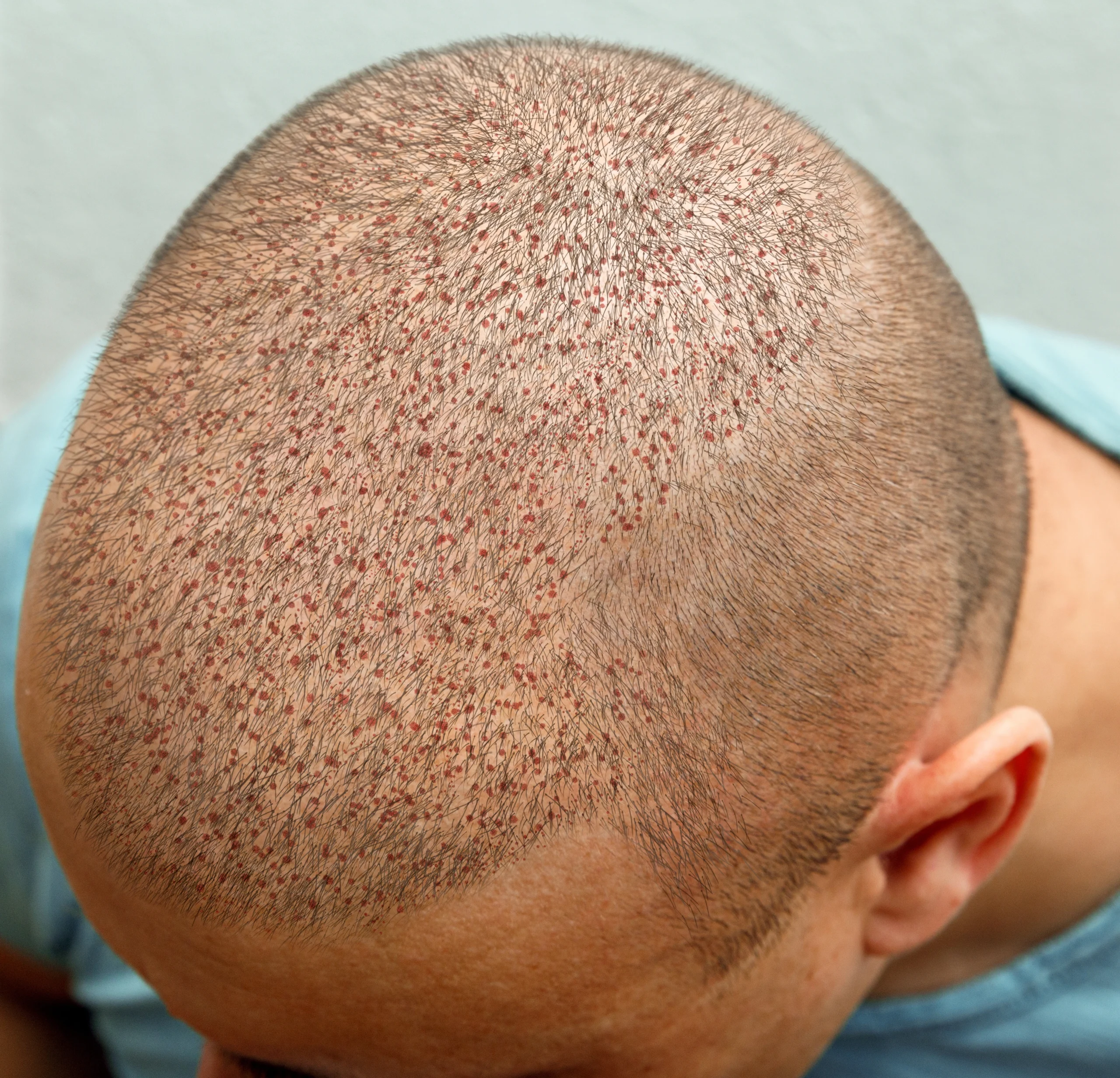 after-hair-one