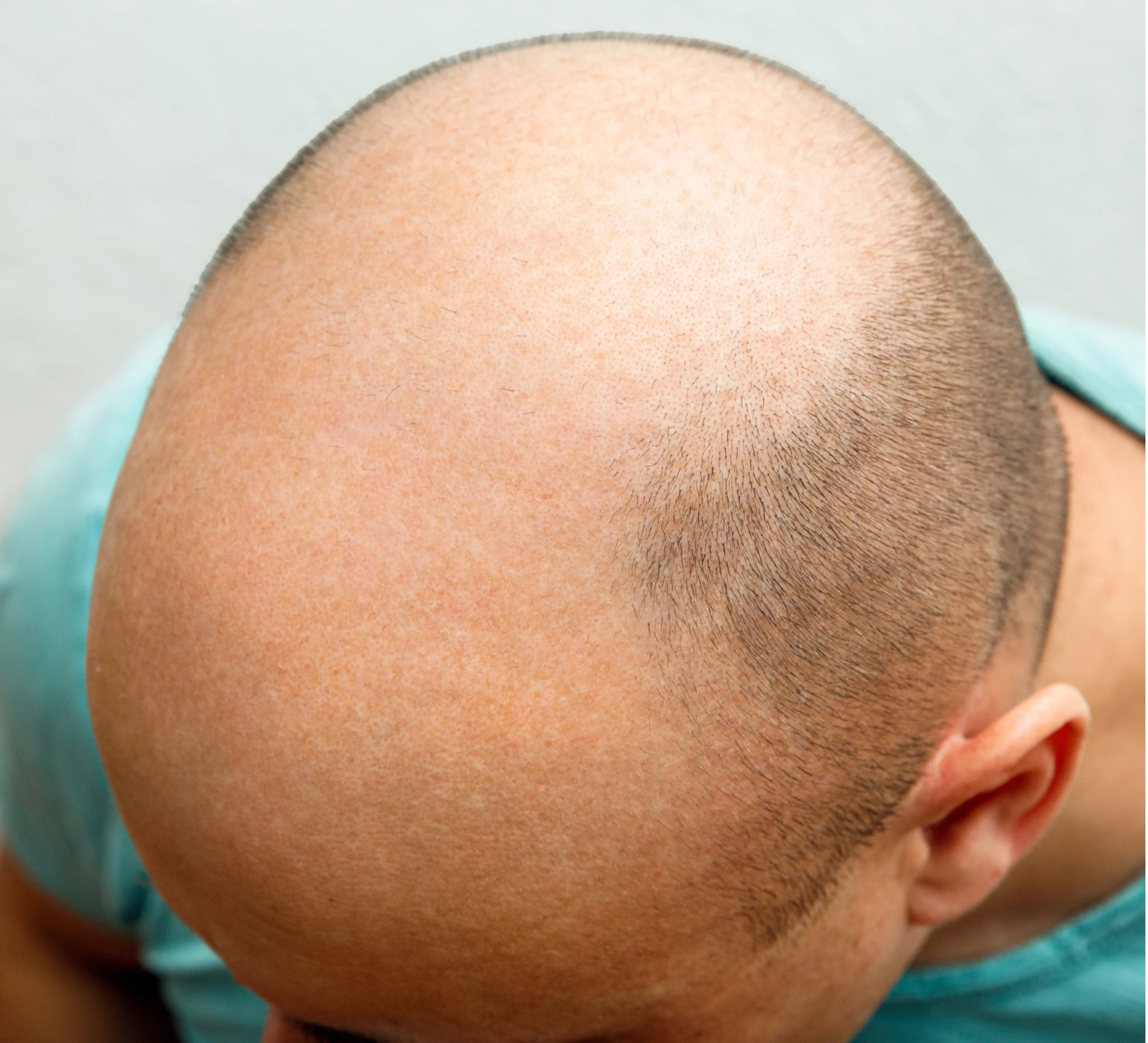 before-hair-one