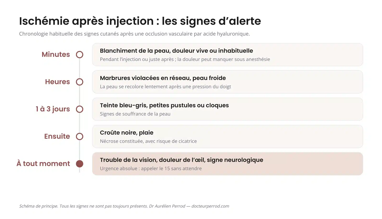 Frise des signes d'alerte d'une ischémie après injection d'acide hyaluronique : blanchiment, marbrures, teinte bleu-gris, nécrose, trouble visuel